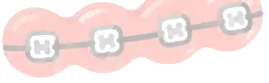 A row of teeth wearing pink and grey braces