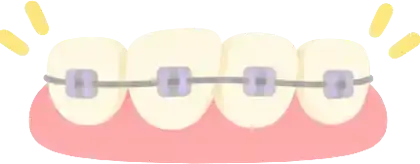 Teeth with braces on pink gums and small yellow sparkle lines